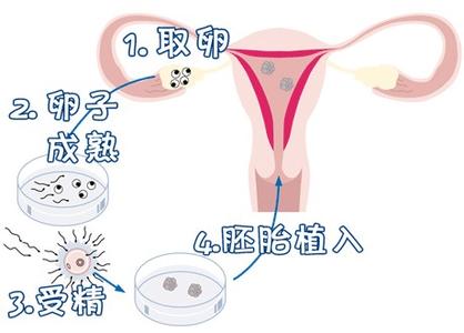 关于靠谱试管代孕机构